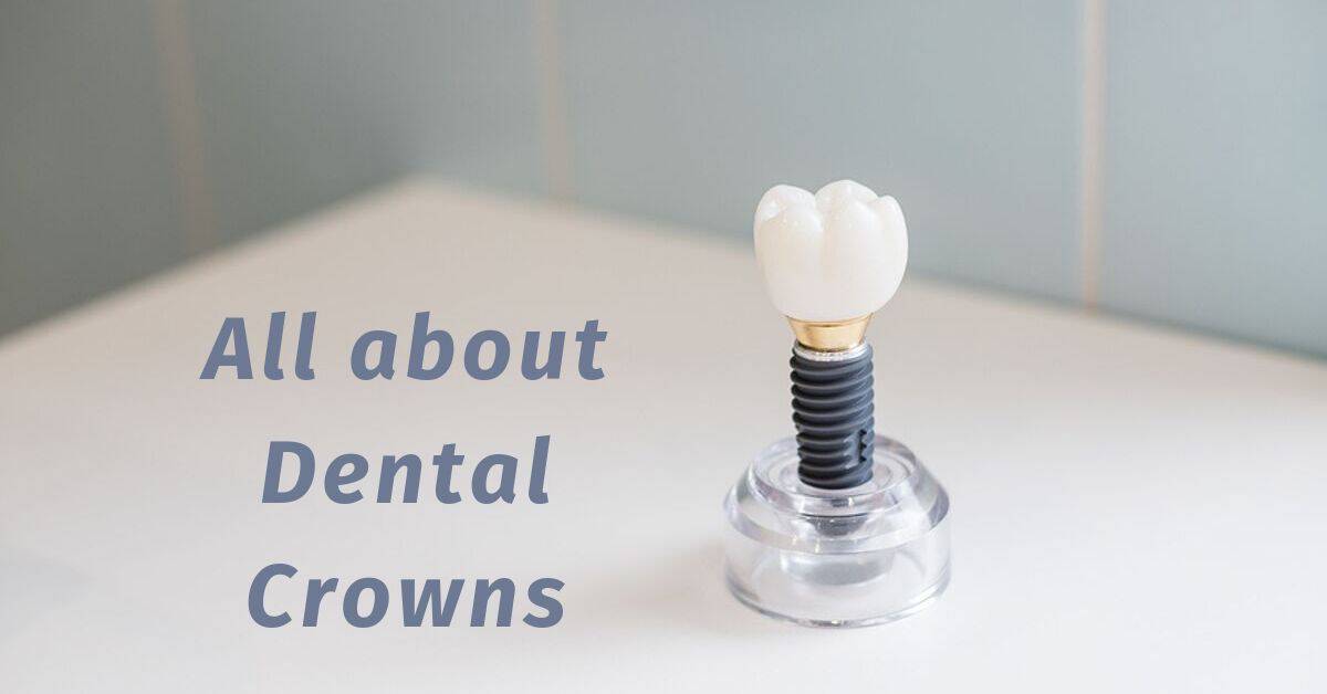 Because it covers two appointments, the procedure for installing a dental crown is a pretty time-consuming procedure. But it is definitely worth it. The crown help alleviates toothache and prevents the tooth from being damaged any further.