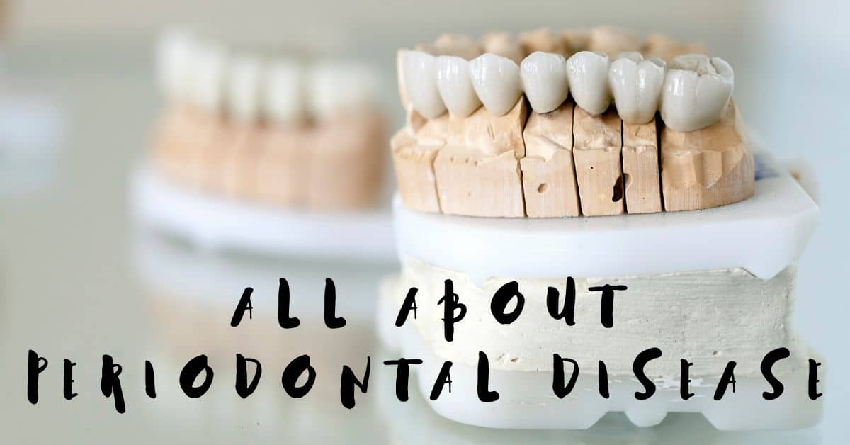 All About Periodontal Disease
